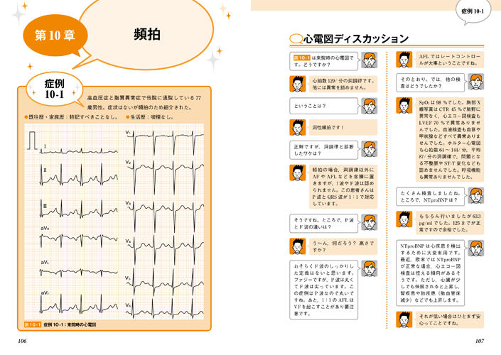 医学出版_書籍_みるみる心電図