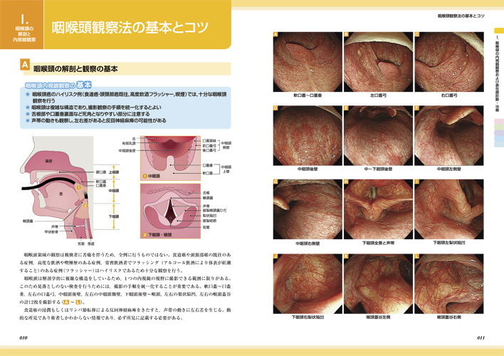 医学出版_書籍_消化管癌の画像強調内視鏡 診断と治療