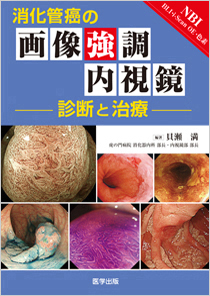 医学出版_書籍_消化管癌の画像強調内視鏡 診断と治療