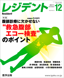 Wfg11N12