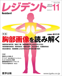 月刊レジデント13年7月号