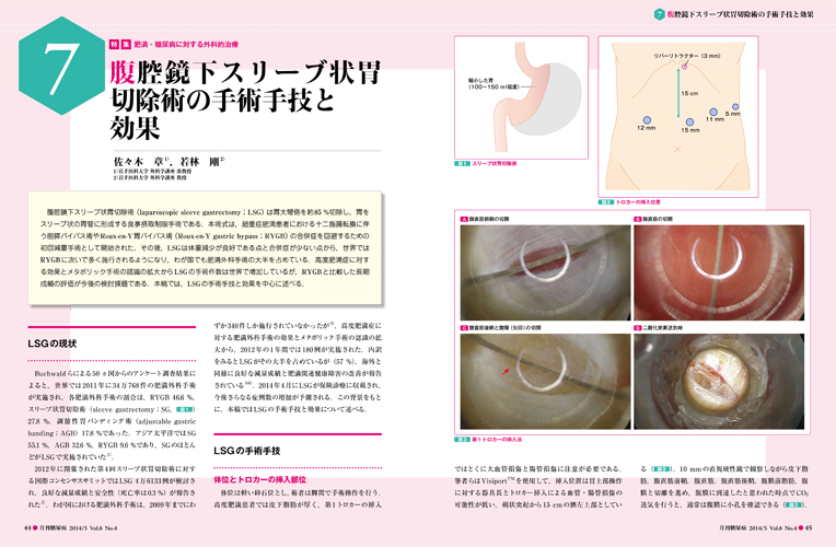 メタボリックサージェリーClinical Update メタボリックサージェリー Clinical Update | オンラインストア