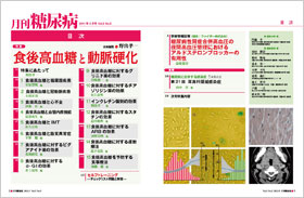 月刊糖尿病  Ｖｏｌ．５Ｎｏ．１１（２０１３ /医学出版/野出孝一（単行本） 医学出版_月刊糖尿病11年5月号