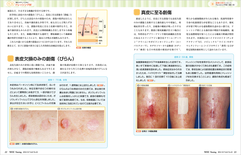 医学出版_WOC Nursing 14年12月号