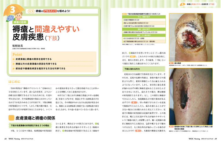 医学出版_WOC Nursing 15年6月号